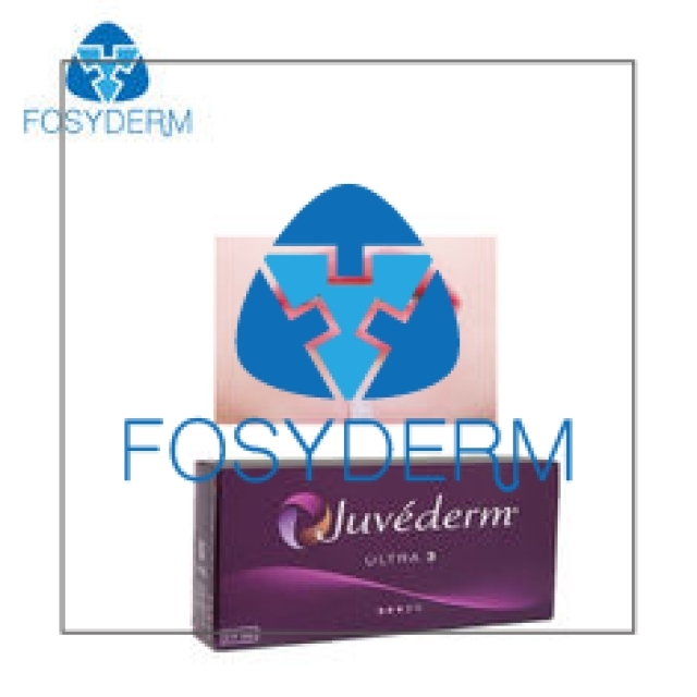 Lip Juvederm Ultra 3 Hyaluronic Acid Dermal Filler 2*1ml