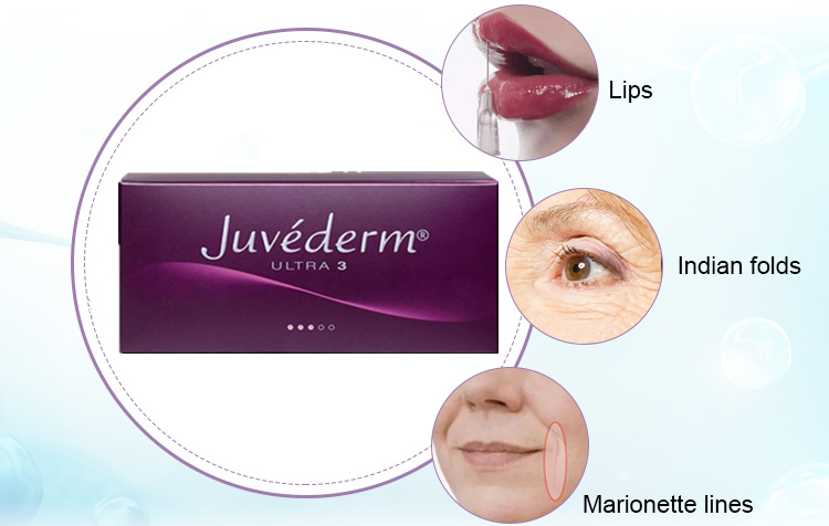 Hyaluronic Acid Dermal Filler Lip Augmentation Juvederm Ultra3 1ml*2pcs