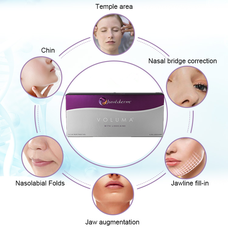 Allergan Injectable Hyaluronic Acid Gel Dermal Filler 2ml Juvederm Voluma Nose Up