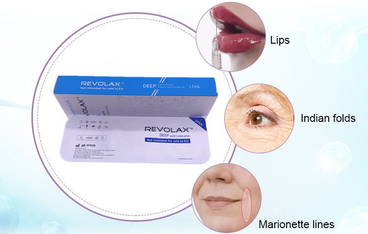2021 Korea Revolax 1.1ml Deep with Lidocaine Hyaluronic Acid Dermal Lip Filler