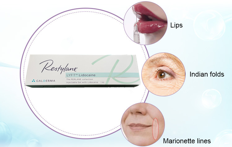 CE Approved Restylane Lyft Hyaluronic Acid 1ml Dermal Filler