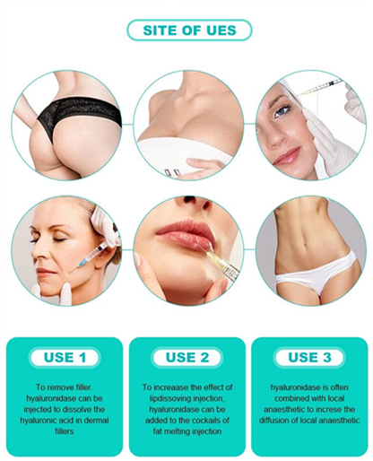 Korea Liporase Dissolves HA Dermal Filler Liporase Injection Hyaluronidase