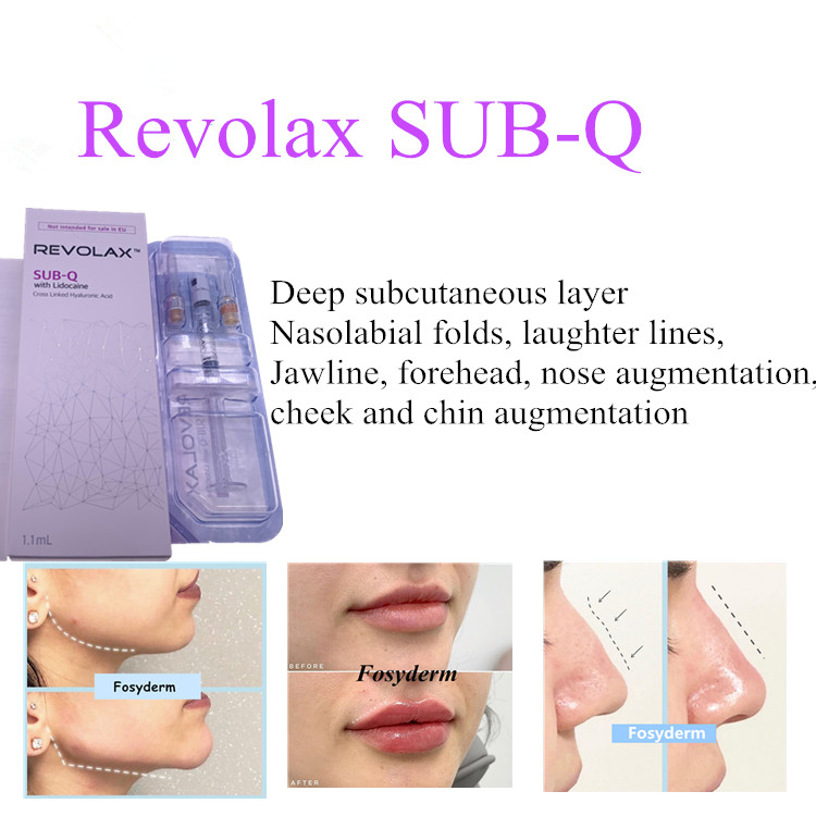 Hot Sale Revolax SUB-Q 1.1ml Filler Injectable HA Dermal Filler Facial Plastic Revolax