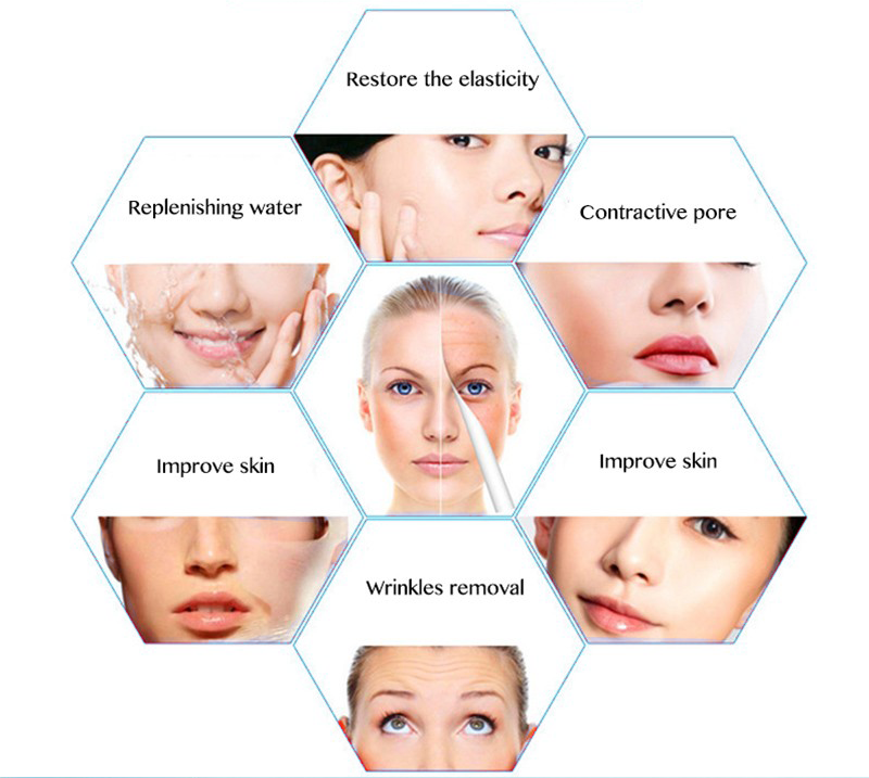 1ml Restylane Lidocaine Hyaluronic Acid Dermal Filler Anti Wrinkles