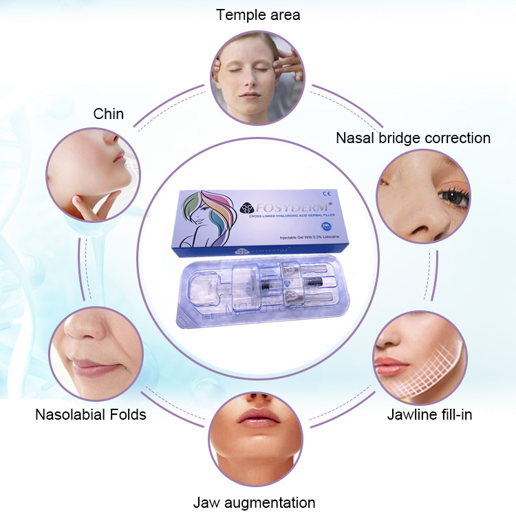 2ml Deep Hyaluronic Acid Dermal Fillers Injection for Nose Up