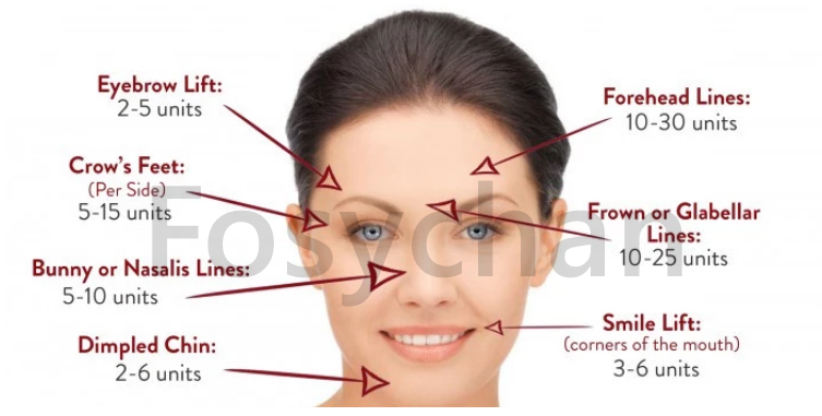 Anti Aging Anti Wrinkles Botulinum Botox Injection 100units Botox Type A