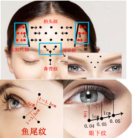 Best Selling Product Wrinkles Removal Anti Aging Face Contor Dermal Filler HA Injectable Botulax