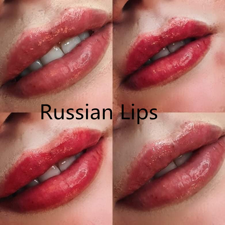1 . 1 ml Nonsugical Russian Lips Augmentation  Hyaluronic Acid Dermal Lips Filler