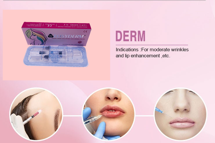 Fosyderm 1ml Derm Line Dermal Filler For Lips Enhancement