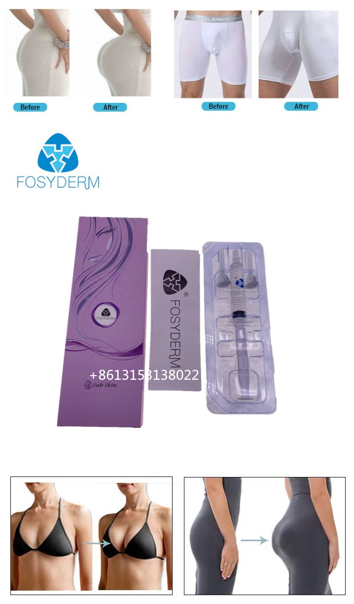 20ml Breast Enhancement HA Dermal Filler Buttock Injection 24mg/ml