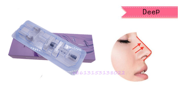 Fosyderm 5ml Deep Dermal Filler for Shaping Facial Contour