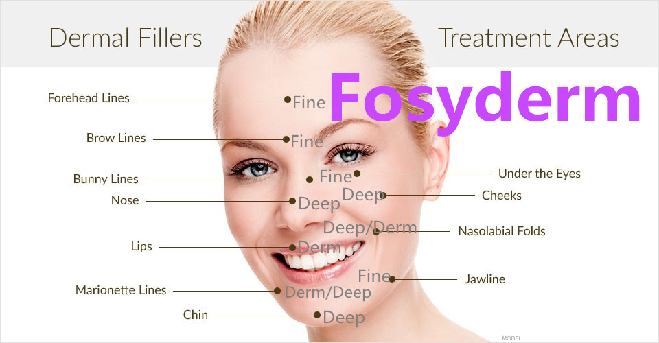 2 ml Lidocaine Painless Injectable Hyaluronic Acid Dermal Filler for Nasolabial Folds