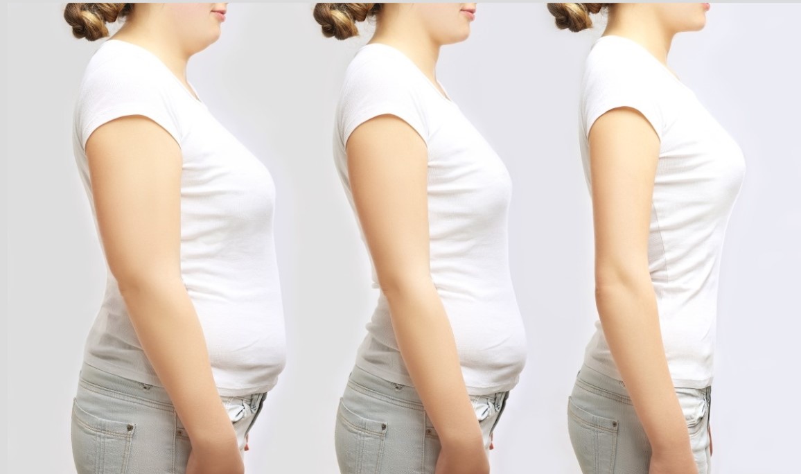 HYAMELY Lipolytic Solution To Removing Fat For Slimming With 10 Ml * 10 Vials