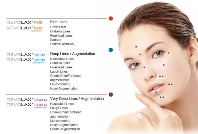 Revolax Sub-Q with Lidocaine 1.1ml Hyaluronic Acid Dermal Filler