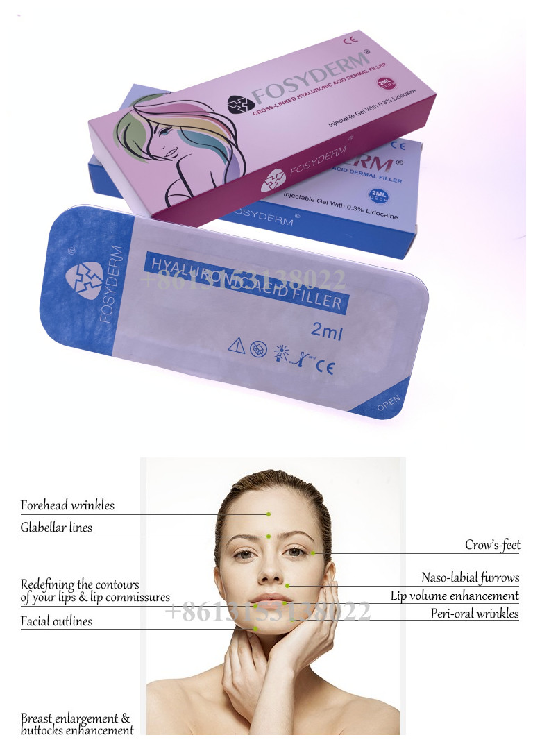 2ml Deep Cosmetic Product Injectable Dermal Filler Cross Linked hyaluronic Acid