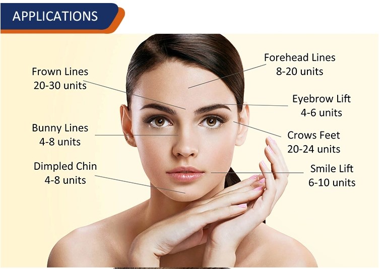 Anti Wrinkles Injection Botox Toxin 100iu Botulinum Toxin