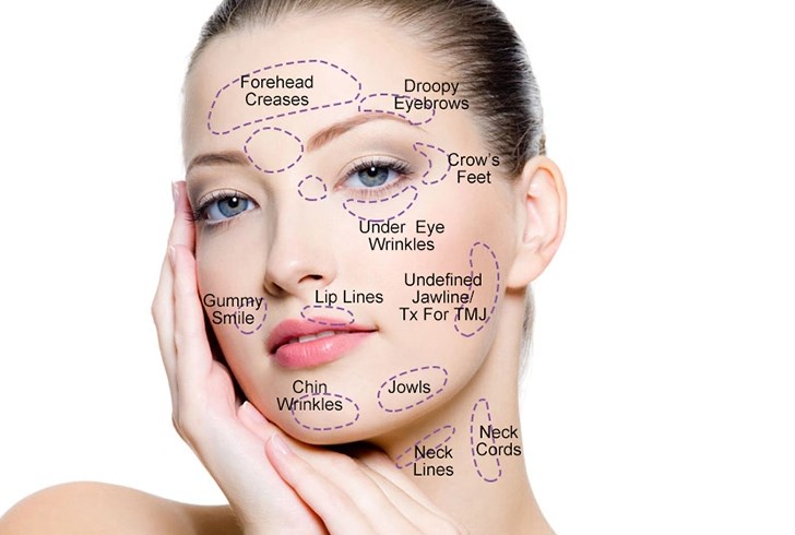 Anti Wrinkles Injection Botox Toxin 100iu Botulinum Toxin