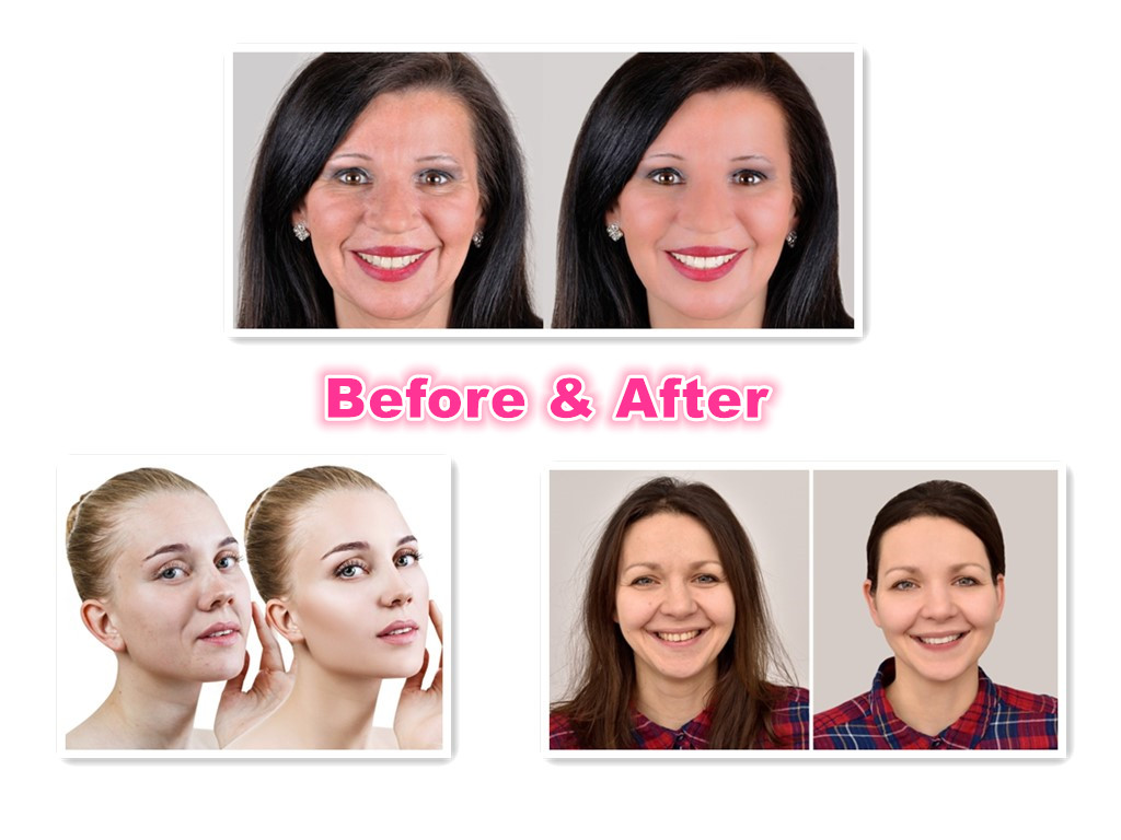 Made In China Type A 100 IU Botox To Reducing Wrinkles On Facial