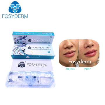 Fosyderm Hyaluronic Acid Dermal Filler 1ml Derm Lip Enhancement Injectable Dermal Fillers