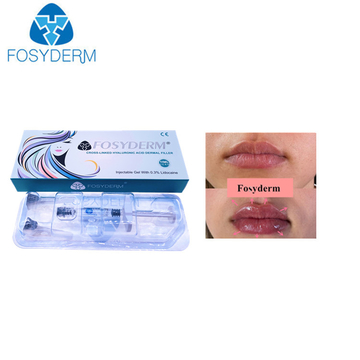 Fosyderm Hyaluronic Acid Dermal Filler 1ml Derm Lip Enhancement Injectable Dermal Fillers