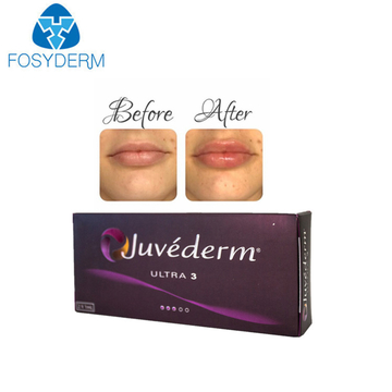 Hyaluronic Acid Dermal Filler Lip Augmentation Juvederm Ultra3 1ml*2pcs