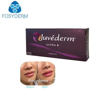 Hyaluronic Acid Dermal Filler Lip Augmentation Juvederm Ultra3 1ml*2pcs