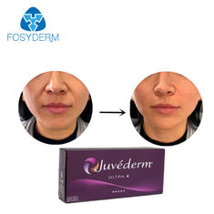 Juvederm Cross Linked Hyaluronic Acid Dermal Filler Allergan Ultra 4