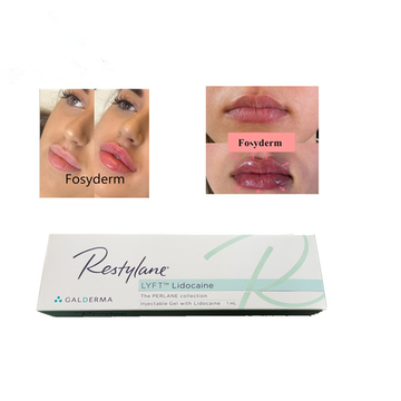 CE Approved Restylane Lyft Hyaluronic Acid 1ml Dermal Filler