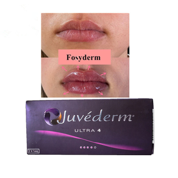 ​24mg / Ml Ultra4 Injectable Hyaluronic Acid Gel Dermal Filler For Lips 2*1ml