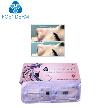 Fosyderm Face Filler 1ml Deep Line HA Dermal Chin Nose Filler