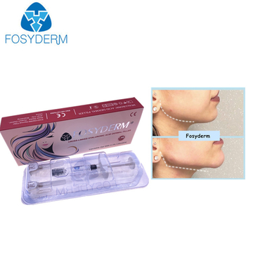 Fosyderm Face Filler 1ml Deep Line HA Dermal Chin Nose Filler