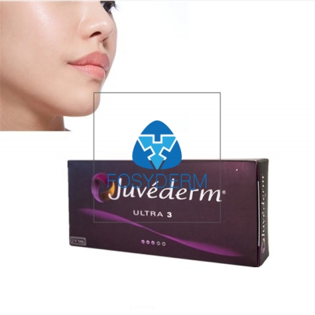 2*1ml Juvederm Ultra3 Lip Injections Juvederm Hyaluronic Acid Dermal Filler