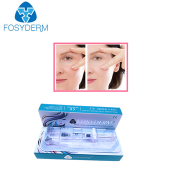 High Quality 1.1ml Hyaluronic Acid Dermal Filler Lip Augmentation with Lidocaine