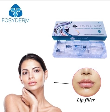 1ml Hyaluronic Acid Dermal Filler Injections to Increase Lips Size