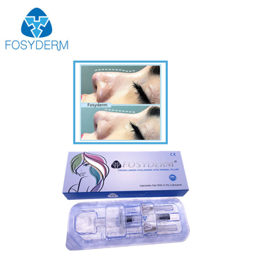 2 ml Deep Line Hyaluronic Acid Dermal Filler for Nose Up with Lidocaine