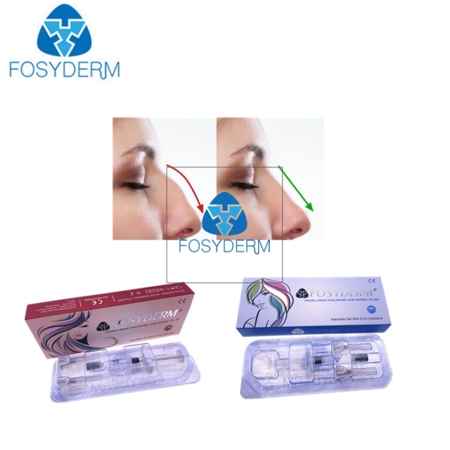 2 ml Deep Line Hyaluronic Acid Dermal Filler for Nose Up with Lidocaine