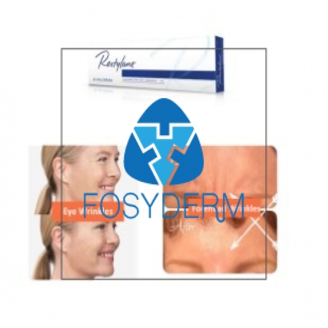 Restylane Lidocaine 1ml Anti Wrinkles Hyaluronic Acid Dermal Filler