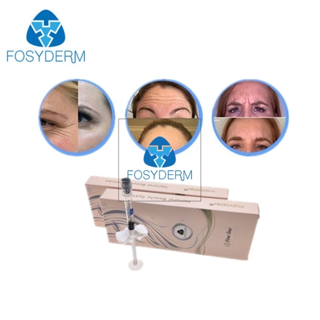 Fosyderm Fine Lines Injectable Dermal Filler for Eye Contours 1ml