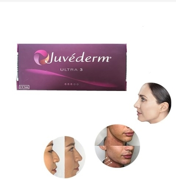Juvederm Ultra3 Injectable Dermal Filler HA Gel Injection