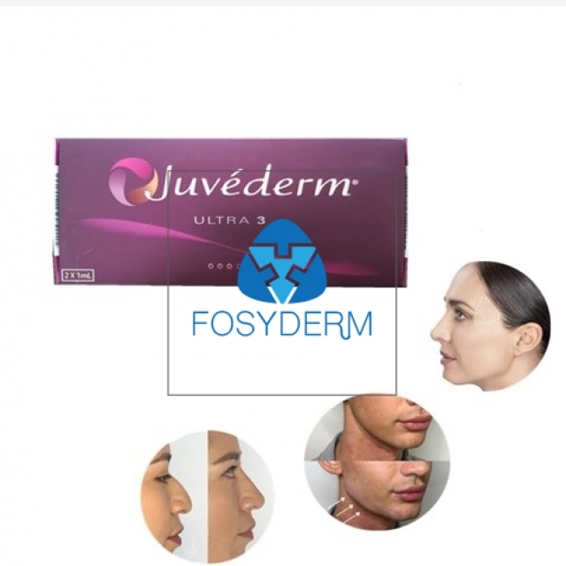 Juvederm Ultra3 Injectable Dermal Filler HA Gel Injection