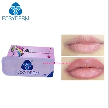 CE Injectable Ha Hyaluroinc Acid Lip Fullness Dermal Filler 2ml