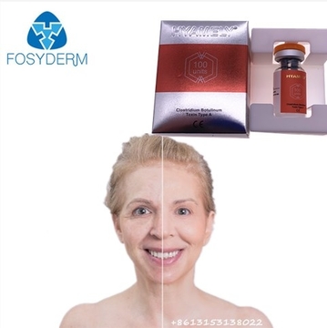 Korea Hyamely Botox Botuliumme toxin type A injection 100units