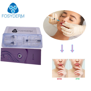 Lips Filler By Injecting Fosyderm 5 ML Derm Hyaluronic Acid